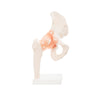 Modelo Anatomico Articulacion de Cadera Tamaño Natural